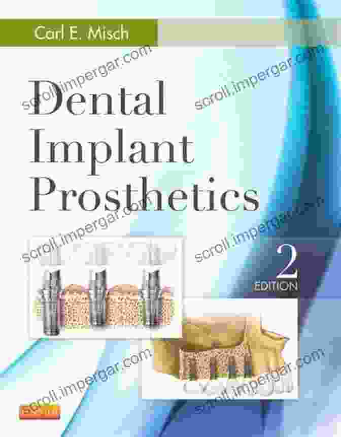 Dental Implant Prosthetics Book Cover Dental Implant Prosthetics E