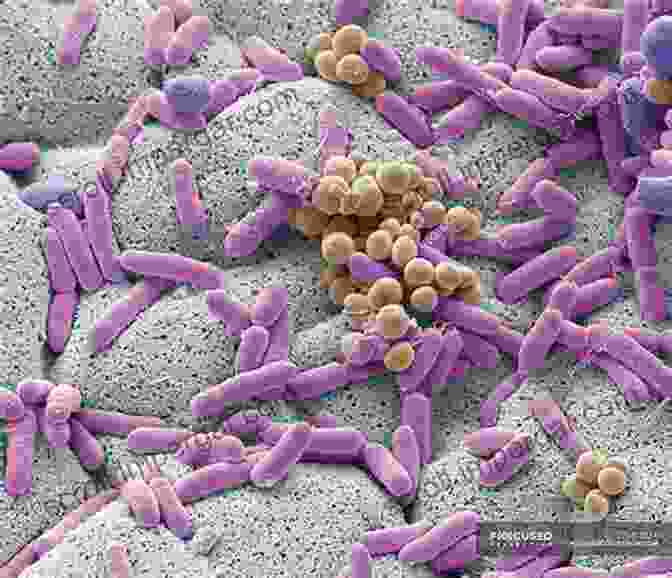 Scanning Electron Microscope Image Of Bacteria Outbreaks And Epidemics: Battling Infection From Measles To Coronavirus (Hot Science)