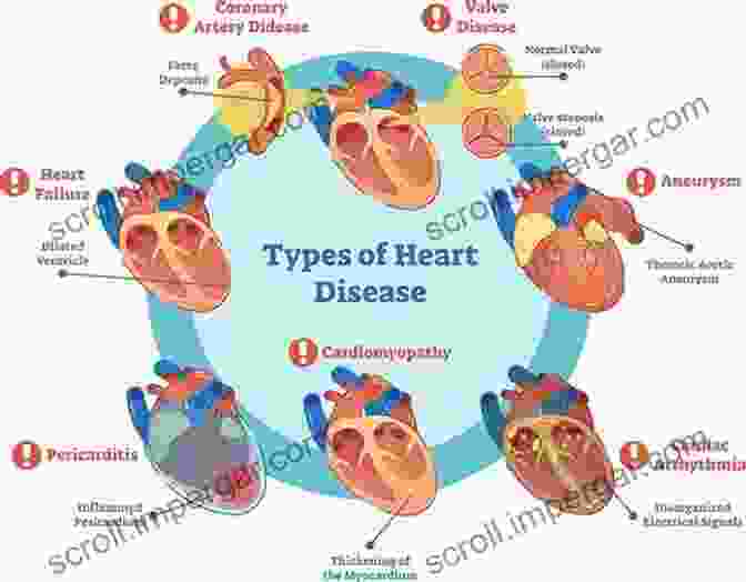 Types Of Heart Diseases The Heart Made Easy (Cardiology Made Easy 1)